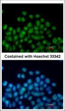 NK2 homeobox 5 Antibody