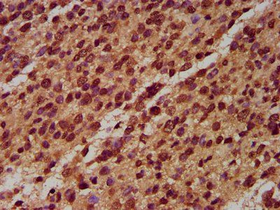 NLRP6 Antibody