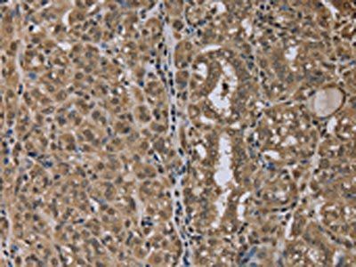 NLRP6 Antibody