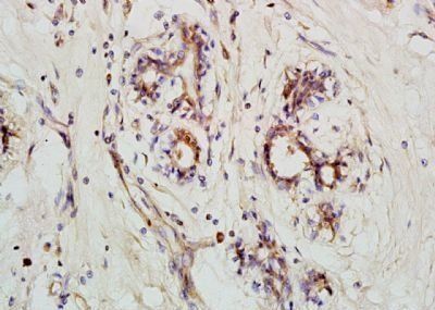 NOD26/NLRX1 Rabbit Polyclonal Antibody