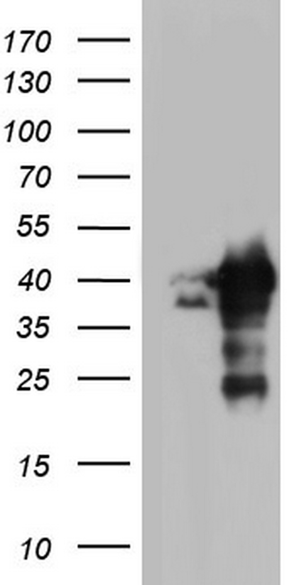 NME1 Antibody