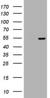 NM23A Antibody