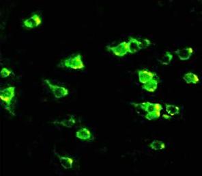NMDAR2B/GRIN2B Rabbit Polyclonal Antibody