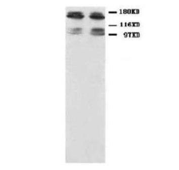 NMDAR2B/GRIN2B Rabbit Polyclonal Antibody