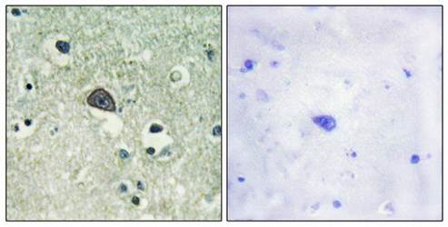 NMDAR1 (Phospho-Ser890) Antibody