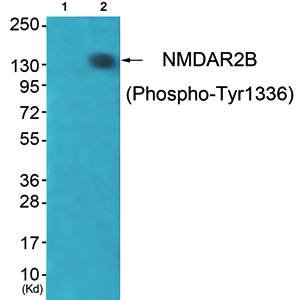 NMDAR2B (Phospho-Tyr1336) Antibody