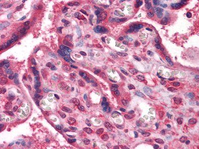 NME1 Antibody