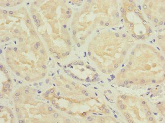 NME3 Antibody