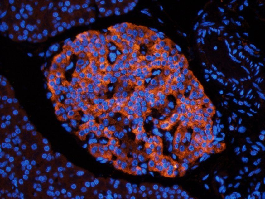 NMUR2 Rabbit Polyclonal Antibody