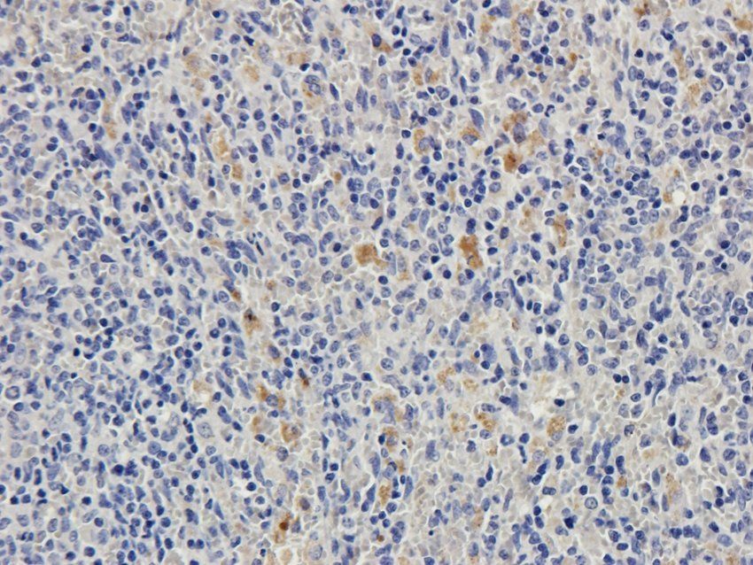 NMUR2 Rabbit Polyclonal Antibody