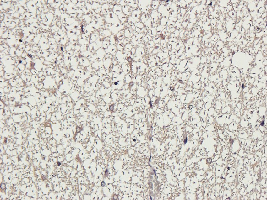 NMUR2 Rabbit Polyclonal Antibody