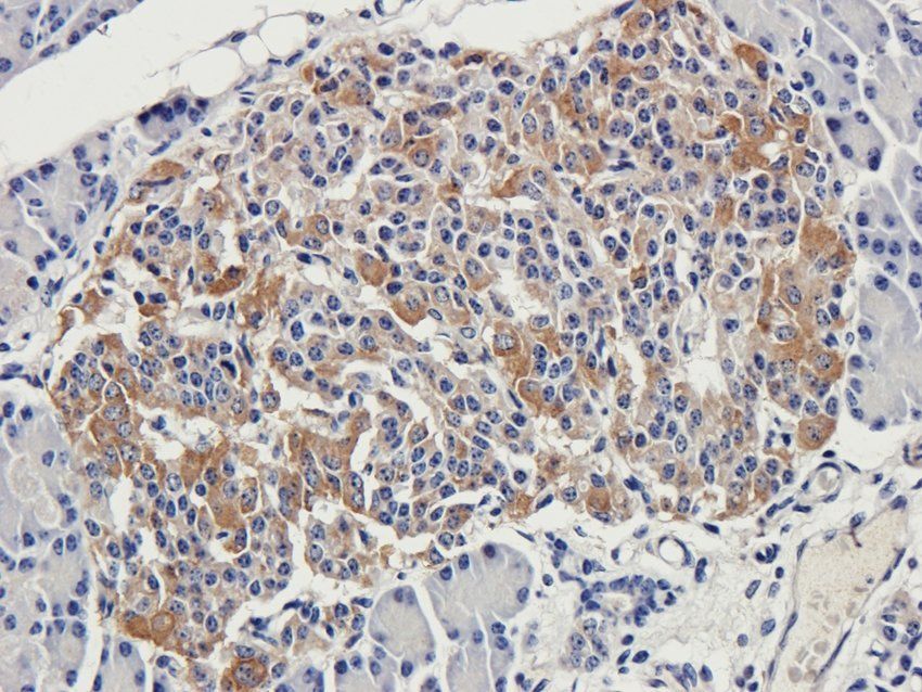 NMUR2 Rabbit Polyclonal Antibody