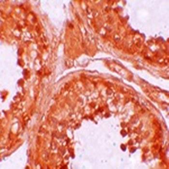 NOD6 Rabbit Polyclonal Antibody