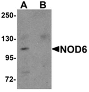 NOD6 Rabbit Polyclonal Antibody