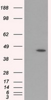 NOTCH1 Antibody