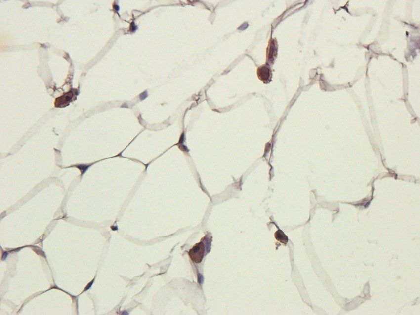 NOTCH3 Rabbit Polyclonal Antibody
