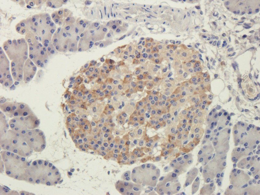 NOTCH3 Rabbit Polyclonal Antibody