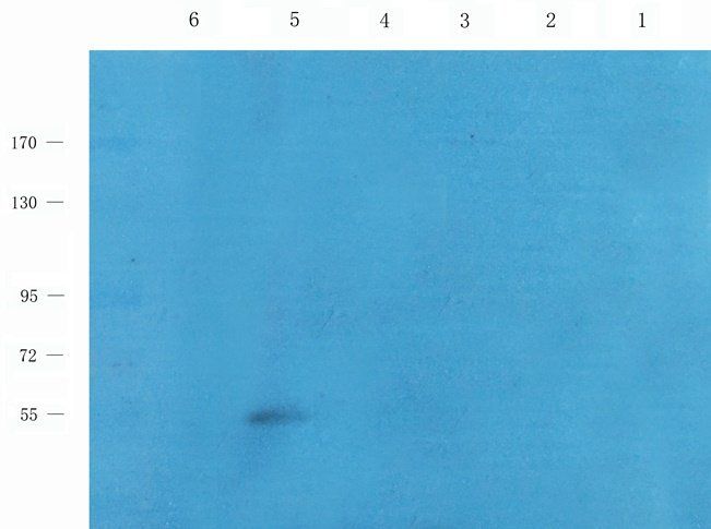 NOTCH3 Rabbit Polyclonal Antibody