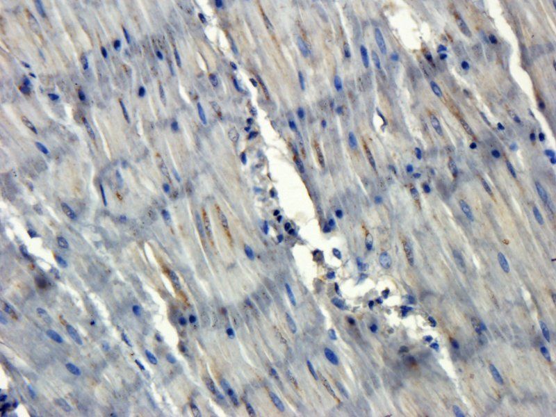 NOX1 Rabbit Polyclonal Antibody