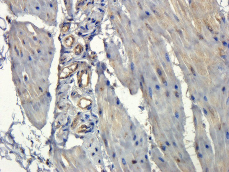 NOX1 Rabbit Polyclonal Antibody