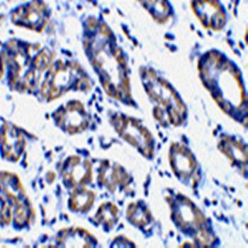 Noxa Rabbit Polyclonal Antibody