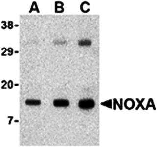 Noxa Rabbit Polyclonal Antibody