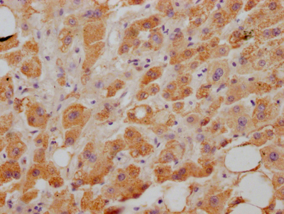 NPC1L1 Antibody