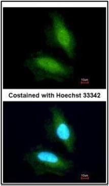 NPEPPS antibody [N3C2-2], Internal