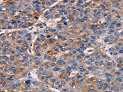 NPM3 Antibody