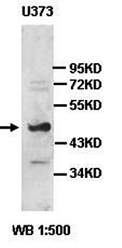 NPSR1 Rabbit Polyclonal Antibody