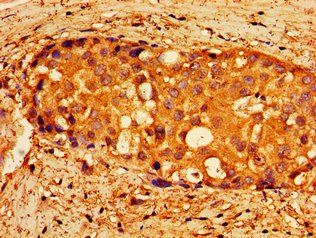 NPTX1 Antibody