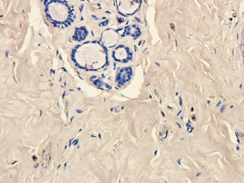 NPY1R Rabbit Polyclonal Antibody