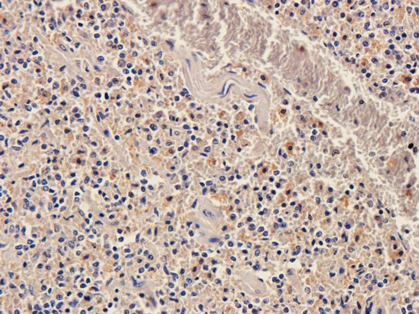 NPY1R Rabbit Polyclonal Antibody