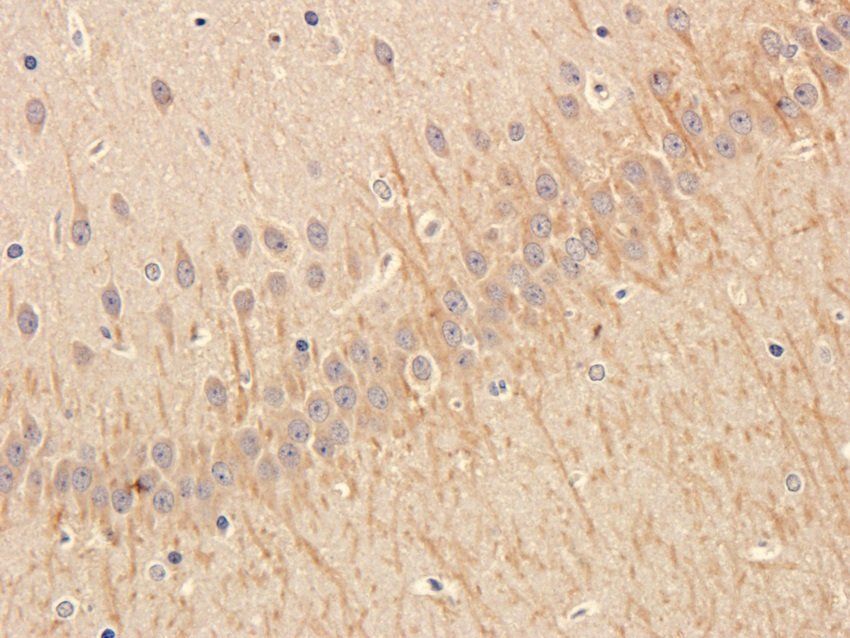 NPY1R Rabbit Polyclonal Antibody