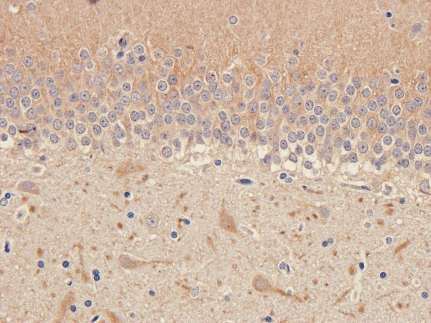 NPY1R Rabbit Polyclonal Antibody