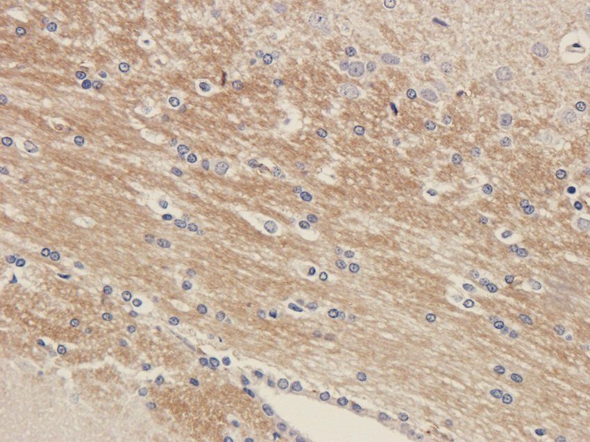 NPY1R Rabbit Polyclonal Antibody