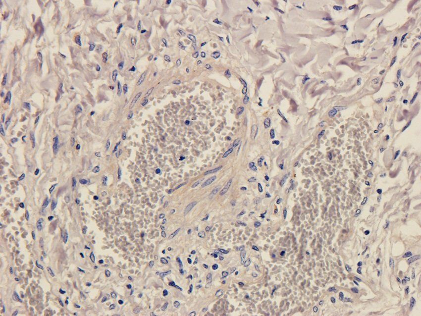 NPY1R Rabbit Polyclonal Antibody