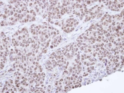 nuclear receptor subfamily 0 group B member 2 Antibody