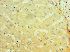 NR1I2 Antibody