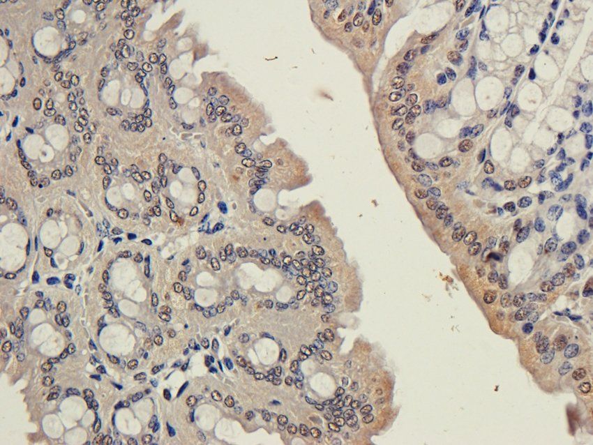NR1I2 Rabbit Polyclonal Antibody