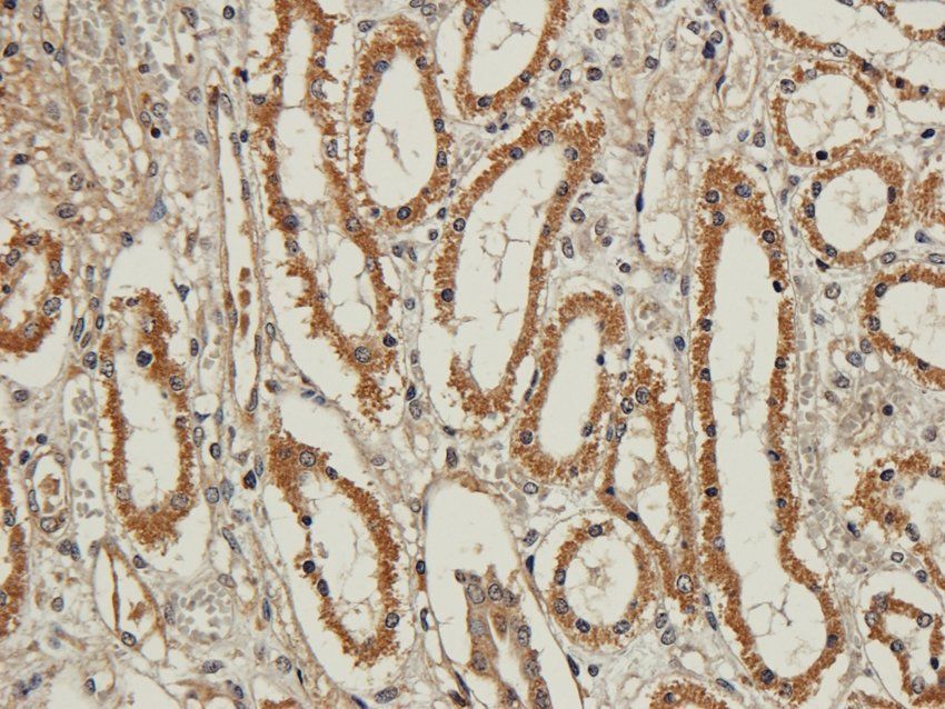 NR1I2 Rabbit Polyclonal Antibody