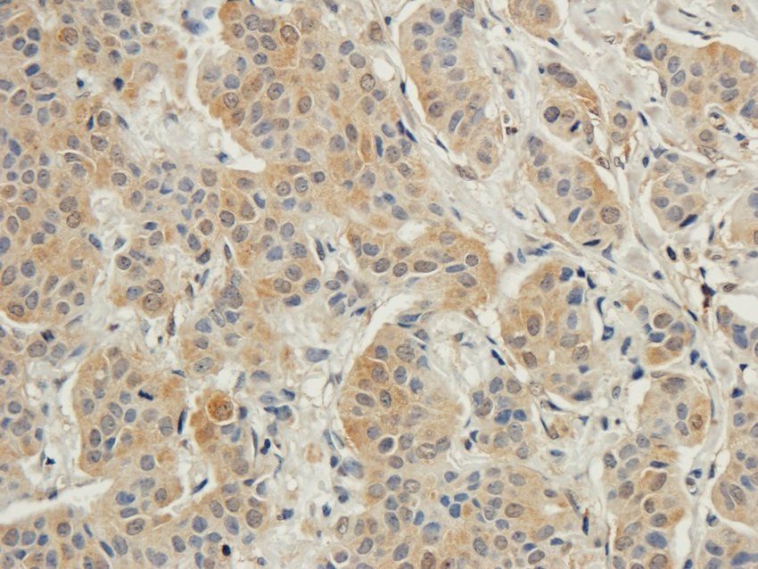 NR1I2 Rabbit Polyclonal Antibody