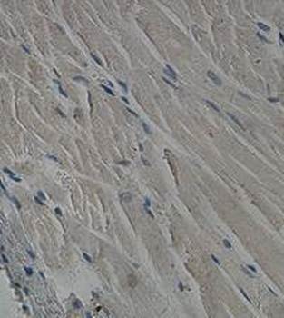 NUR77 Rabbit Polyclonal Antibody