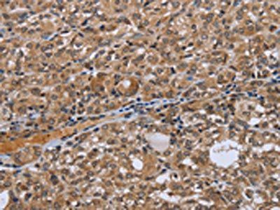 NRP2 Antibody