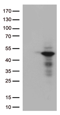 NSD3 Antibody