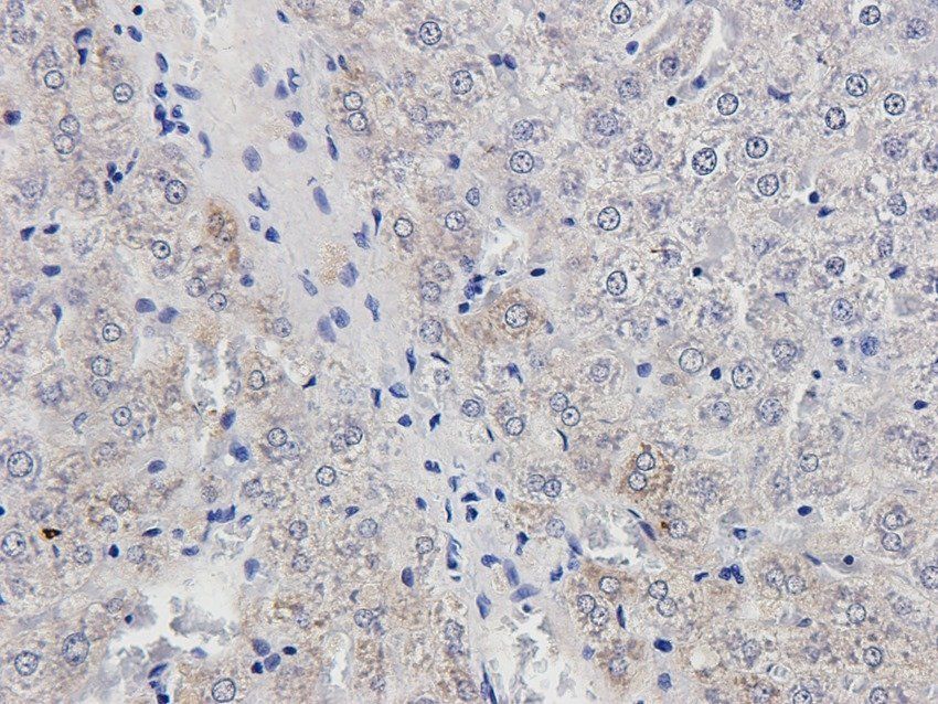 NSF Rabbit Polyclonal Antibody