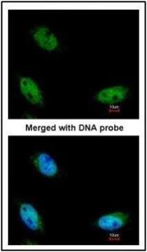 NOP2/Sun RNA methyltransferase 6 Antibody