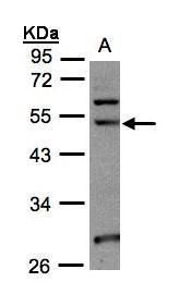 NOP2/Sun RNA methyltransferase 6 Antibody