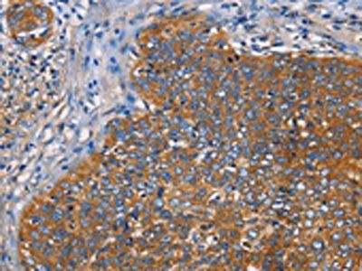 NT5E Antibody