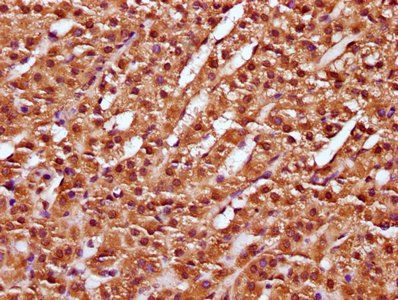 NUBP2 Antibody